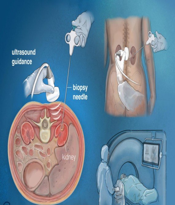 IR Machine